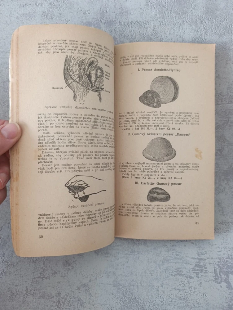 Mechanické prostředky sloužící k zabránění nákazy a těhotenství, r.1930